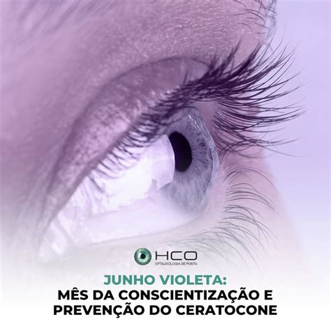 Junho Violeta Mês da conscientização e prevenção do ceratocone HCO