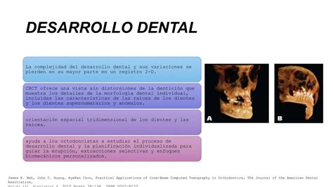 Tomografía Computarizada De Haz Cónico Cbct Pptx