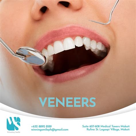 Cost Of Veneers In The Philippines Updated 2024 Winning Smile Dental