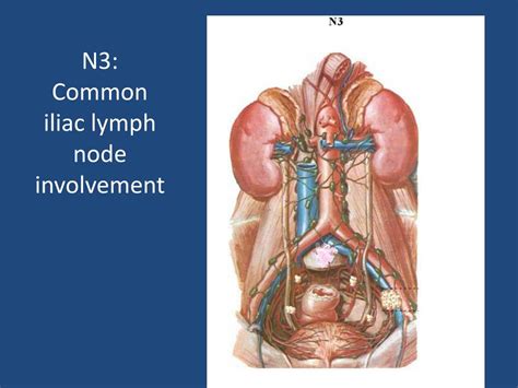 Anatomy Of Pelvic Lymph Nodes And Vessels Kenhub 58 Off