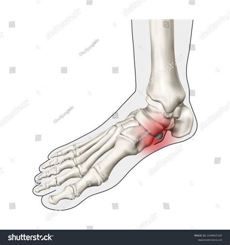 Navicular Bone Location, Anatomy, Labeled Diagram, 53% OFF