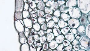 Collenchyma Cells | Function, Structure & Types - Lesson | Study.com