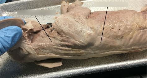 Pig Muscles Back Diagram Quizlet