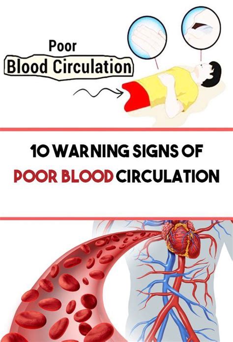 Warning Signs Of Poor Blood Circulation