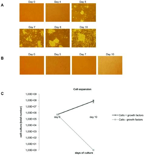 Phenotypic Changes During Cell Culture From Peripheral Blood A Pbmc