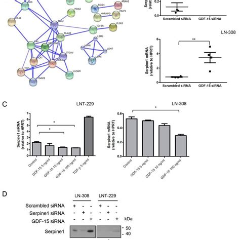 GDF 15 effects on the canonical TGF β signaling pathway in glioma