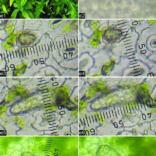 (b1) Live plant; (b2) Cystolith in hypodermal region of leaf (T.S ...