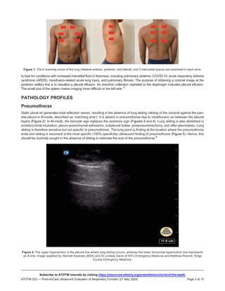 Point Of Care Ultrasound Evaluation Of Respiratory Function Pdf