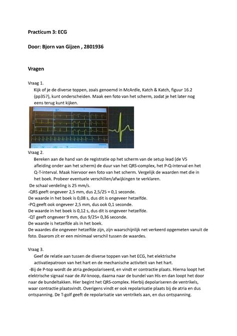 Practicum Iif Practicum Ecg Door Bjorn Van Gijzen