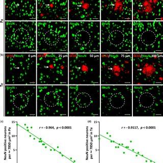 NeuNpositive neuronal loss is correlated with the size of Aβ deposits