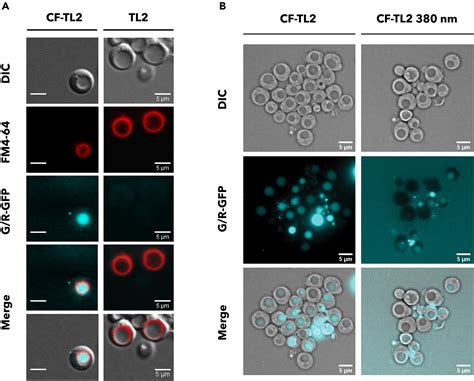 Light Dependent Inhibition Of Clathrin Mediated Endocytosis In Yeast