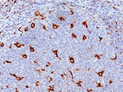 CD68 (Macrophage Marker) Antibody - Clone KP1 - Gene ID 968