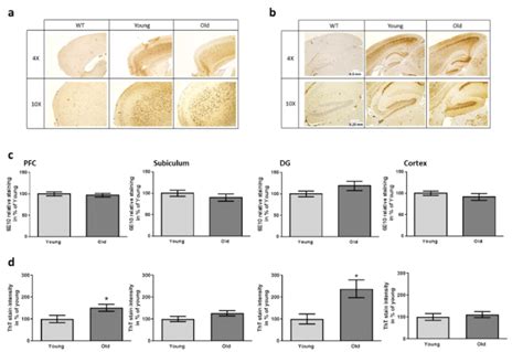 A And Plaque Staining In Brain Regions Of Xfad Mice After Having