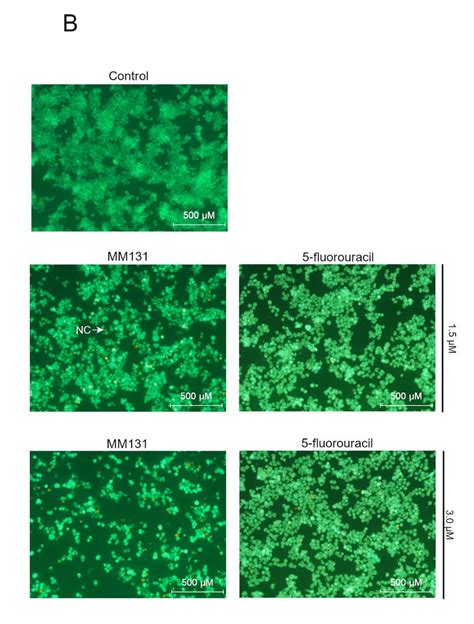 Visualization Of Morphological Specificity Of Colorectal Cancer Cells