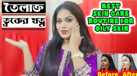 তৈলাক্ত ত্বকের যত্ন Oily Skin Treatment Oily Skin Care Routine Best Skin Care Routine Red