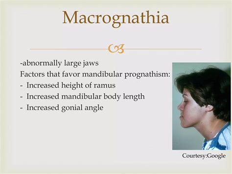 Development of mandible ppt | PPT