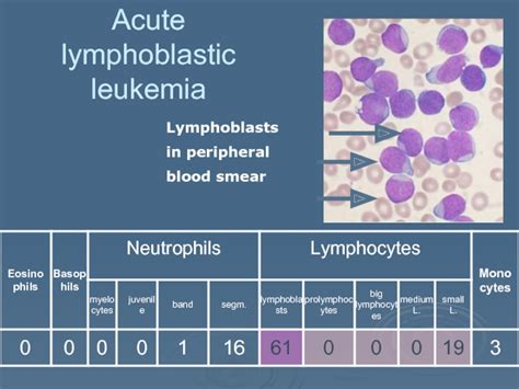 Wbc Pathology Subject 11