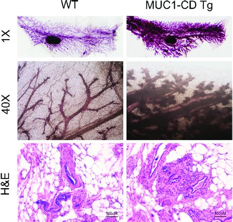 Overexpression Of MUC1 CD Induces Hyperplasia And Tumorigenesis In