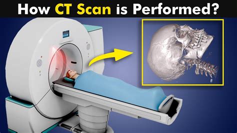 What Is CT Scan How CT Scan Is Performed Urdu Hindi YouTube