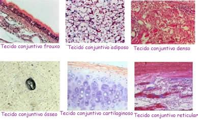 O Tecido Conjuntivo Propriamente Dito Pode Ser Dividido - Histologia Nerd: TECIDO CONJUNTIVO PROPRIAMENTE DITO