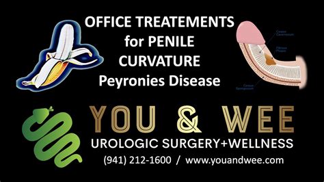 How To Office Treatments For Penile Curvature Peyronies Disease