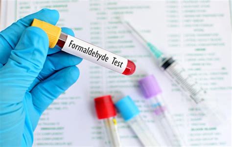 Formaldehyde Exposure And Leukemia Cuny Graduate School Of Public