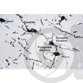 Mammal Cerebral Cortex Neuron Silver Stain X Neuron Mammals