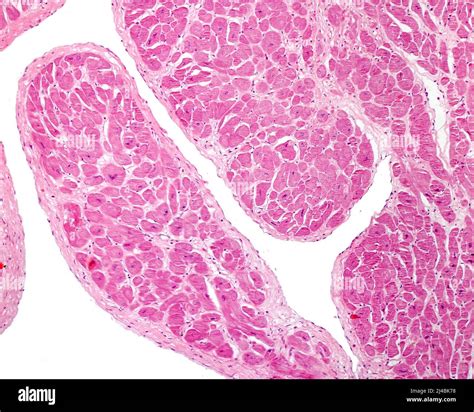 Human heart endocardium, light micrograph Stock Photo - Alamy