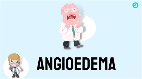 Angioedema: signs & symptoms, causes, and treatment - YouTube