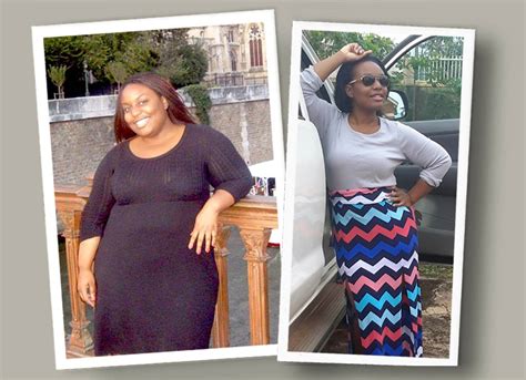 Gastric Sleeve Before And After Pictures And What You Can Expect