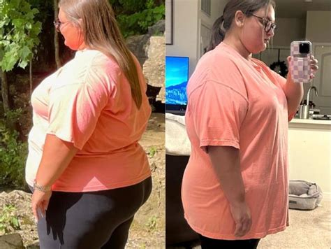 Before And After Semaglutide People On The Game Changer Weight