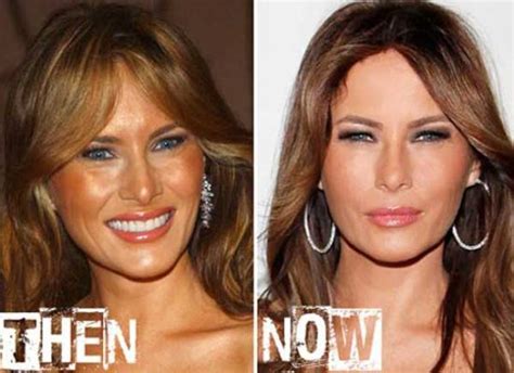 Melania Trump Age, Net Worth, Ethnicity, Ethnicity, Wiki, Husband