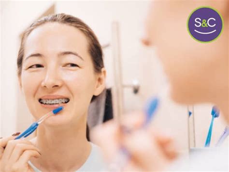 Oral Hygiene During Orthodontic Treatment Sloss And Carpenter Orthodontics