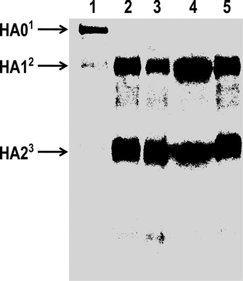 SDS PAGE Analysis Of Polypeptide Fragment Patterns Obtained Following