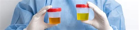 Urine Luck vs. Quick Fix (5 Differences That You Must Know)