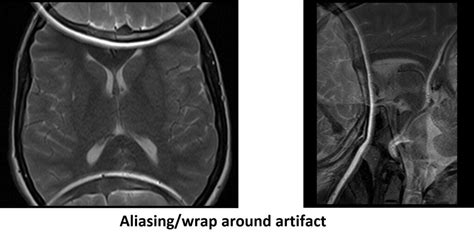 Aliasingwrap Around Artifact