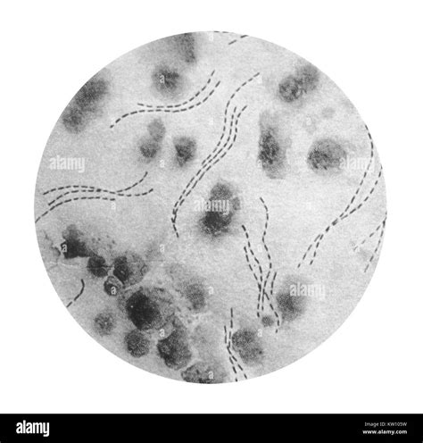 Chancroid bacteria Cut Out Stock Images & Pictures - Alamy