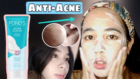 Goodbye Pimples Try The New Ponds Facial Foam Acne Clear Review