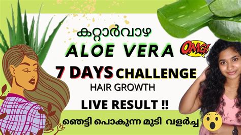 ഞെട്ടി പൊകുന്ന മുടി വളർച്ച😳💯 7 Days Aloe Vera Challenge Live Result Hair Growth Madichiz