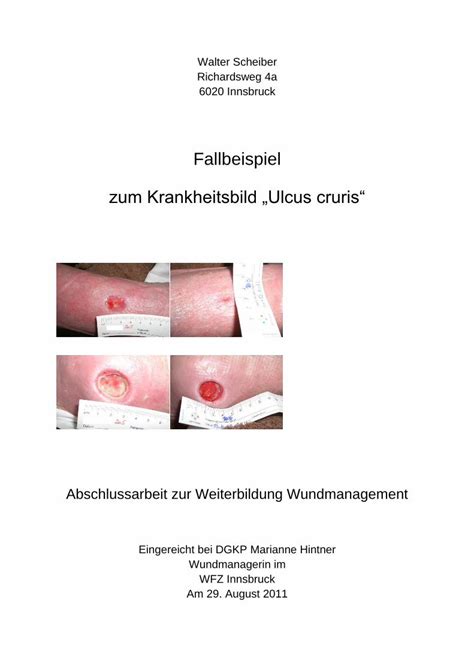 PDF Fallbeispiel Zum Krankheitsbild Ulcus Cruris PDF FileWalter