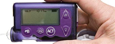 Insulin Pumps Safe And Effective For Up To Five Years In Patients With Type 2 Diabetes Diabetes