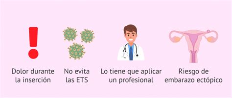 Cómo funciona el DIU Cuáles son sus ventajas y desventajas