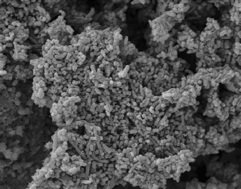 Sem Of Immobilized Cells On Granular Activated Carbon Sampled From