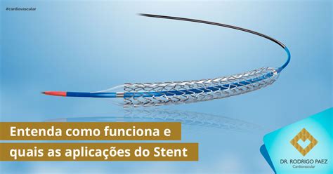 Entenda como funciona e quais as aplicações do Stent Dr Rodrigo