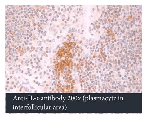 Histopathological And Histoimmunochemical Features Of Lymph Node