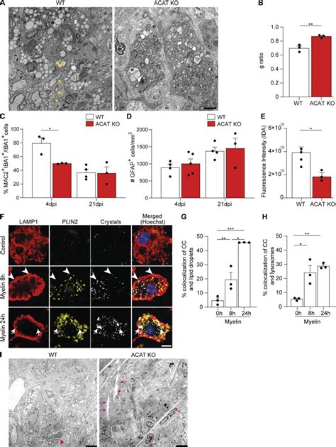 Defective Cholesterol Esterification Affects Remyelination