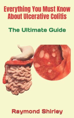 Everything You Must Know About Ulcerative Colitis The Ultimate Guide