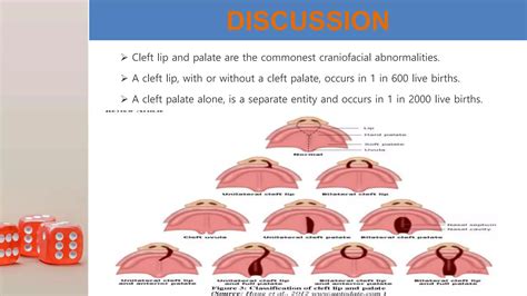 Anesthesia Management Of Cleft Lip And Palate Ppt