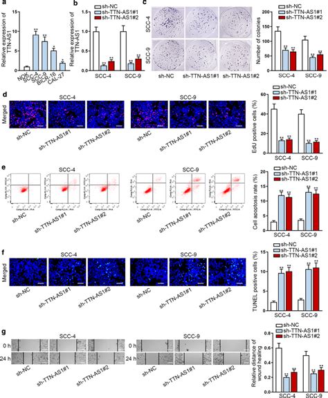 Knockdown Of Ttn As Restrains The Proliferation And Migration Of Oscc