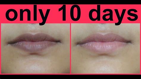 Lip Treatment To Lighten Lips At Tim Malcolm Blog